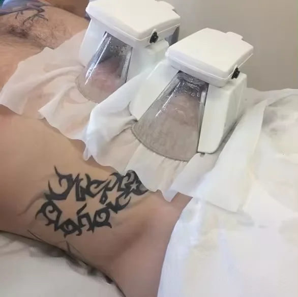 5 in 1 Cryolipolysys Fat Reduce 360 Cellulite Reduction  Machine