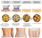 4 Handles Multifunctional Body Shape 360 Cool Cryolipolysis Slimming Machine
