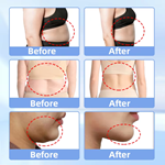 4 Handles Multifunctional Body Shape 360 Cool Cryolipolysis Slimming Machine
