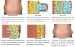 5 in 1 Cryolipolysys Fat Reduce 360 Cellulite Reduction  Machine