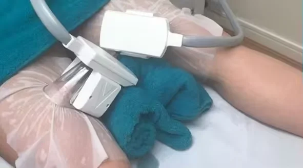 5 in 1 Cryolipolysys Fat Reduce 360 Cellulite Reduction  Machine