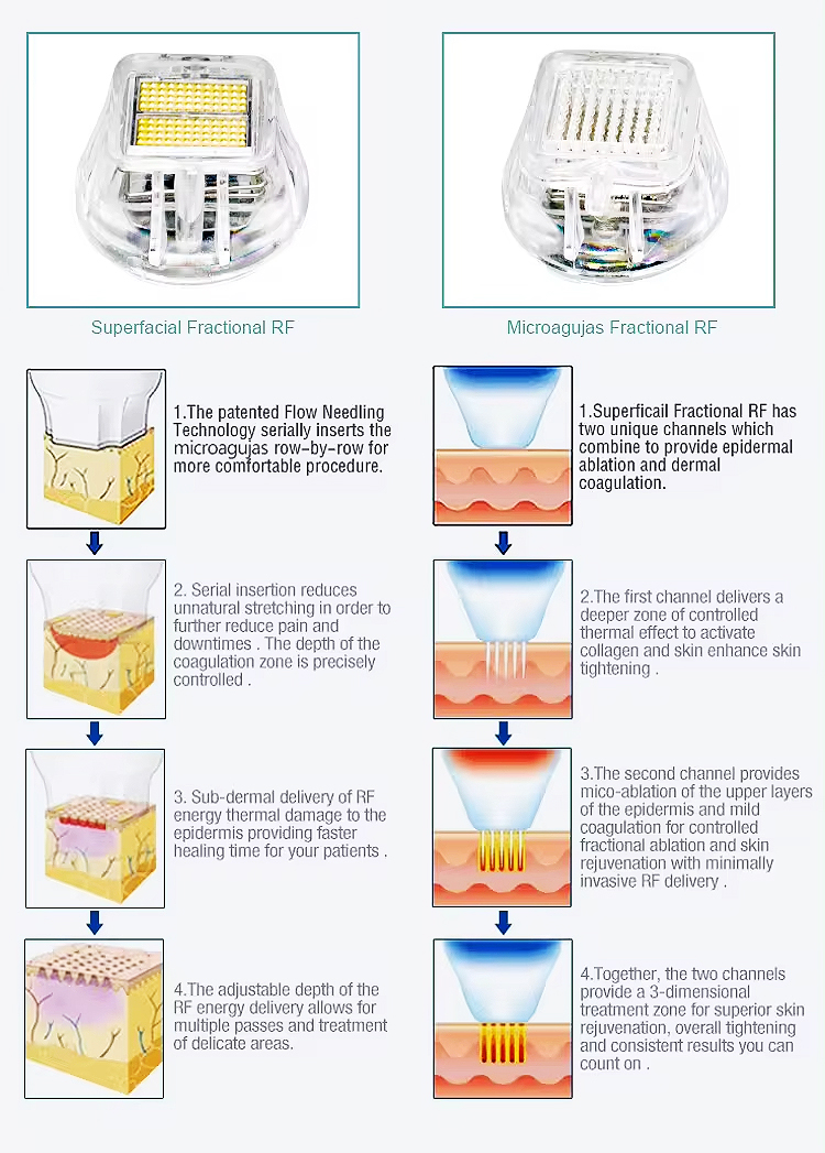 Fractional RF Skin Tightening & Scar Removal Device with 4 Tips