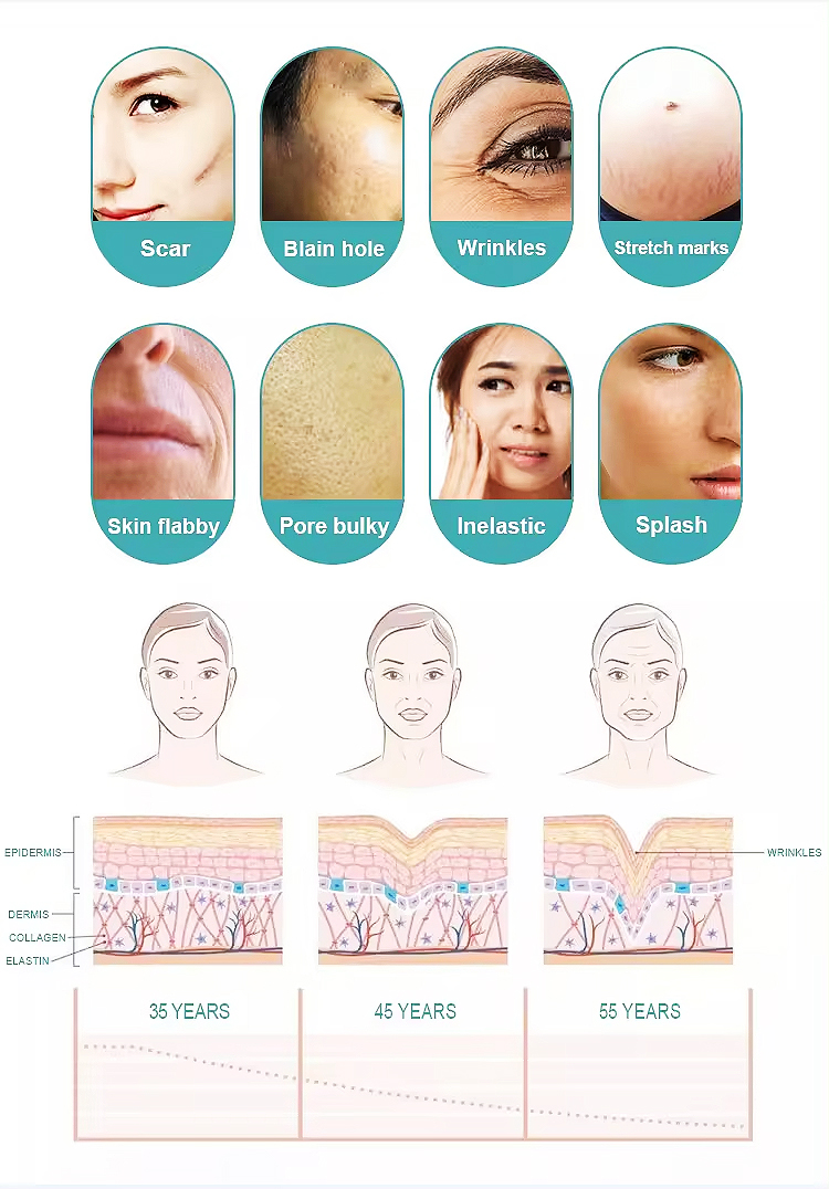 Fractional RF Skin Tightening & Scar Removal Device with 4 Tips