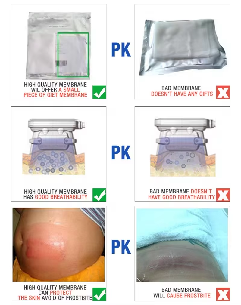 3 Sizes Antifreeze Membrane for Cryolipolyse Slimming Cryolipolysis