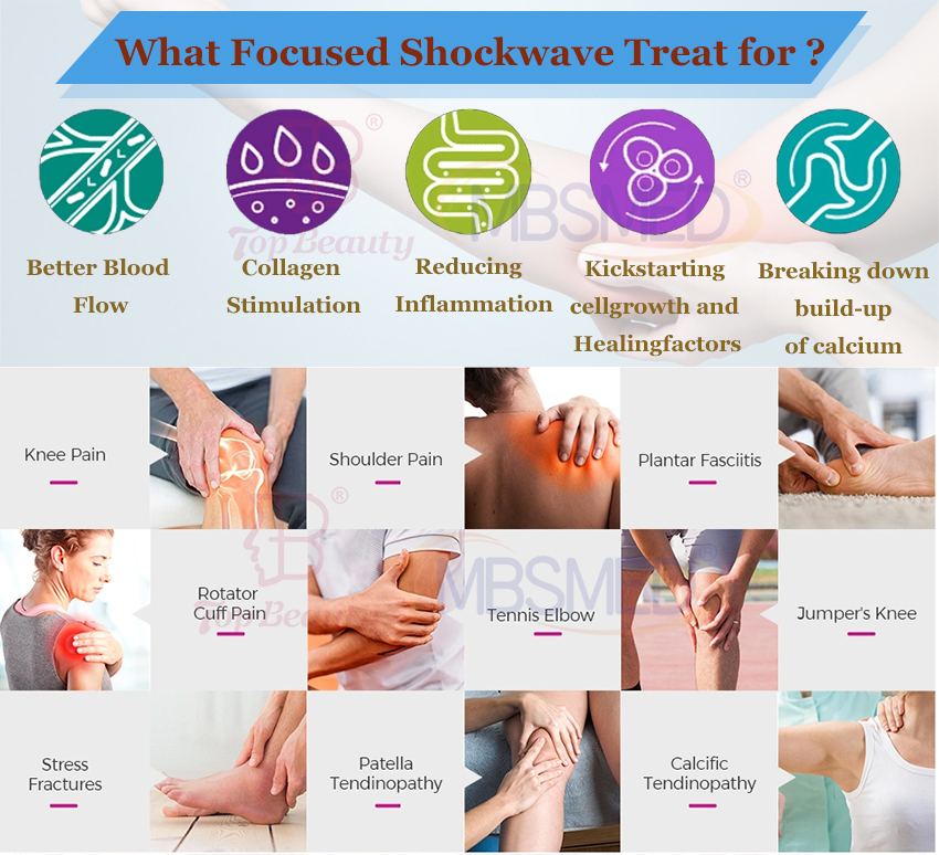 12cm depth Focused Shockwave Therapy Machine for Pain Management & ED Treatment