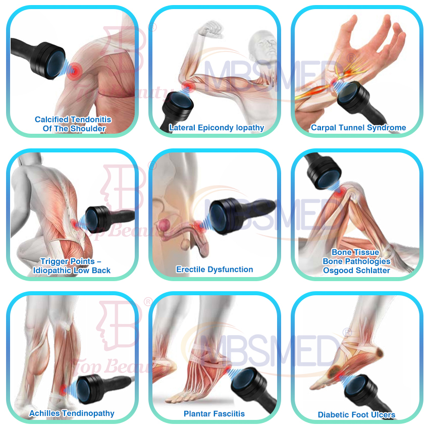 12cm depth Focused Shockwave Therapy Machine for Pain Management & ED Treatment