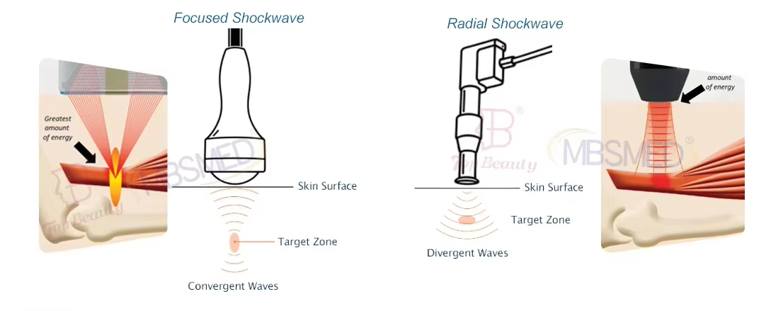 12cm depth Focused Shockwave Therapy Machine for Pain Management & ED Treatment