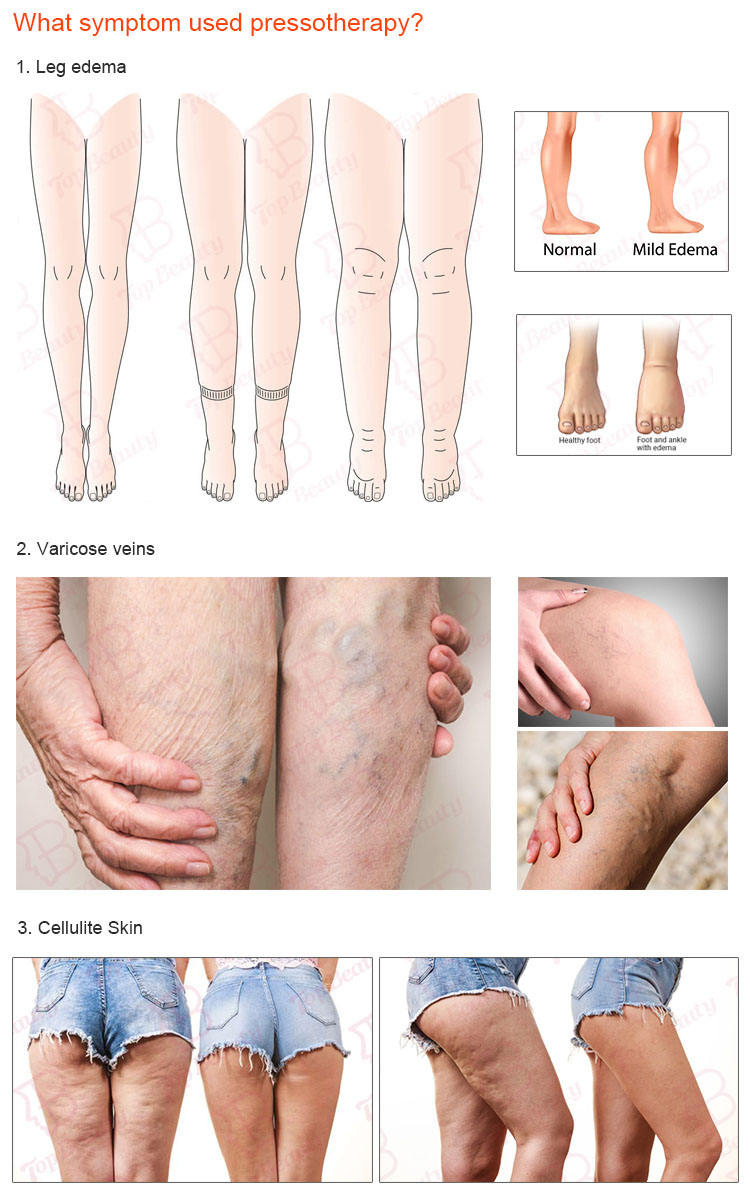 Pressotherapy Air Compression Leg Foot Massager for Sports Recovery Boots
