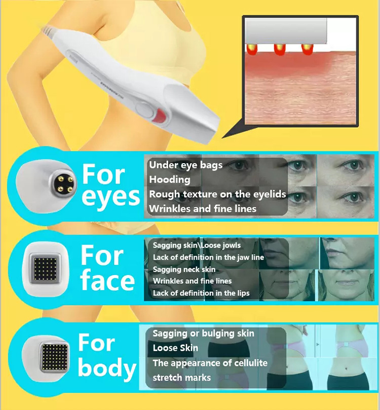 Fractional Rf Anti Aging Face Lifting Skin Tightening Machine