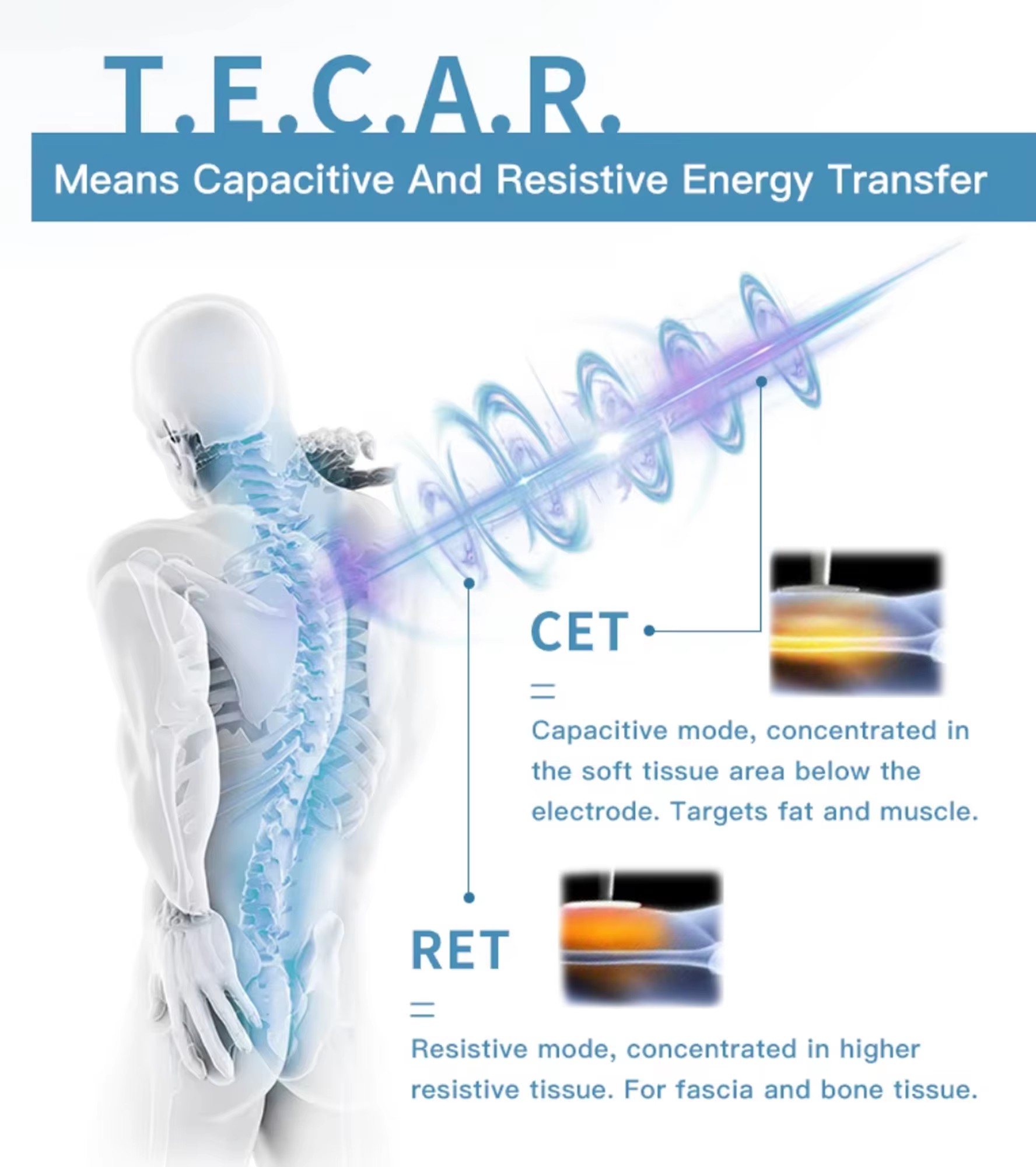 Portable Mini 448kHz Monopolar RF Tecar Therapy Machine
