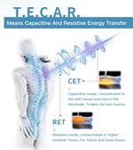 Portable Mini 448kHz Monopolar RF Tecar Therapy Machine