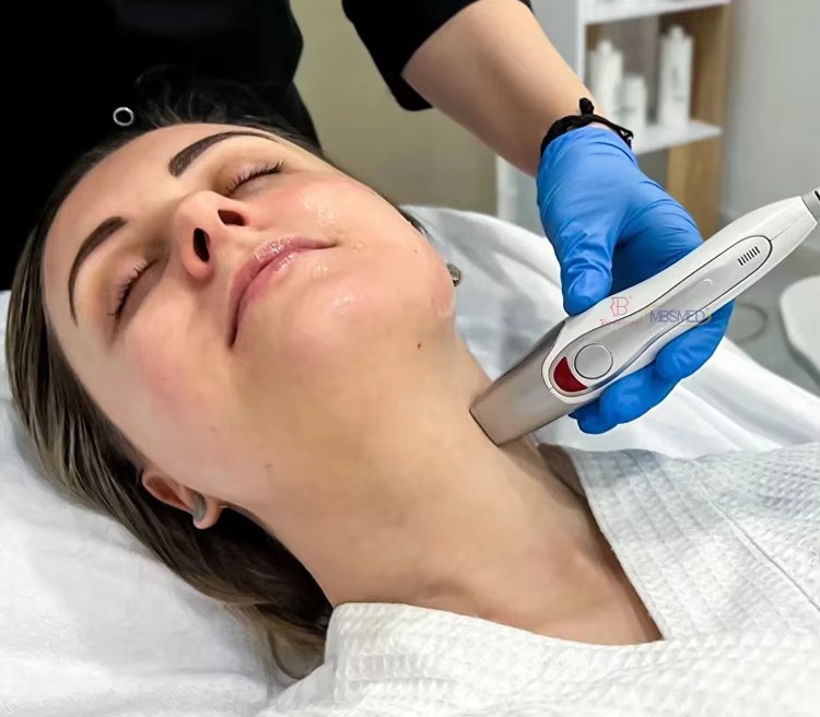 Fractional Rf Anti Aging Face Lifting Skin Tightening Machine