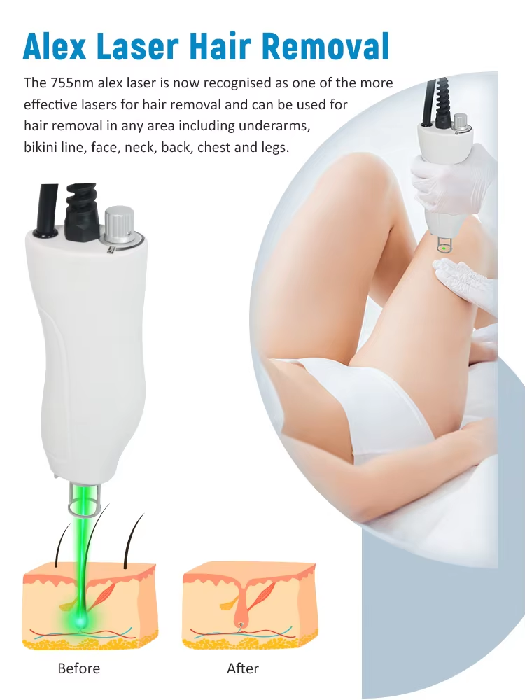 755nm 1064nm Nd YAG Dual Wavelength Laser Hair Removal Tattoo Removal Machine