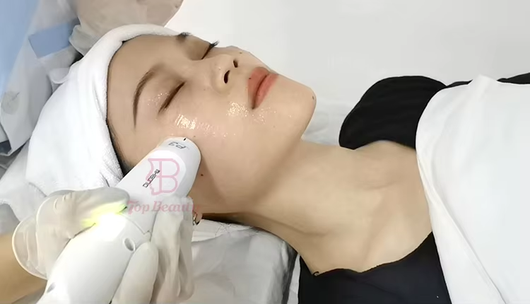 Facial Lifting Skin Tight Forehead Wrinkles Remove HIFU Vmax Beauty Device