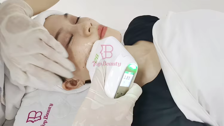 Facial Lifting Skin Tight Forehead Wrinkles Remove HIFU Vmax Beauty Device