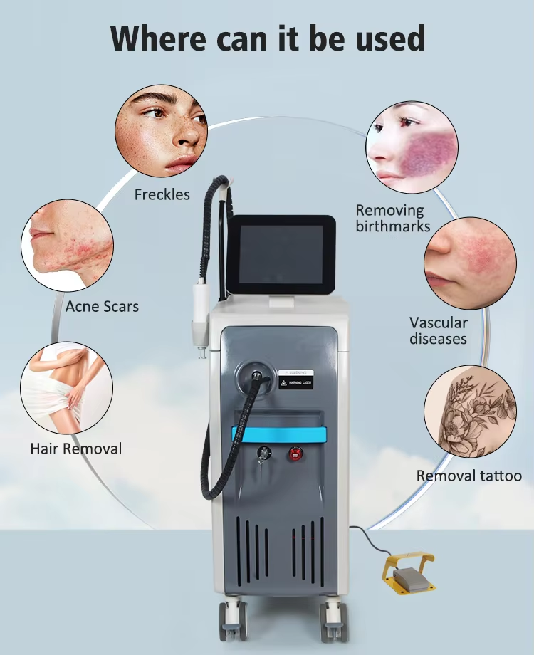 755nm 1064nm Nd YAG Dual Wavelength Laser Hair Removal Tattoo Removal Machine