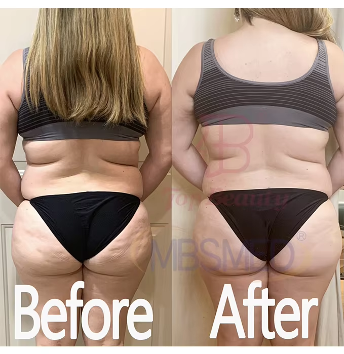 Far Infrared+Pressotherapy 2 in 1 Pressotherapy Machine For Body Slimming