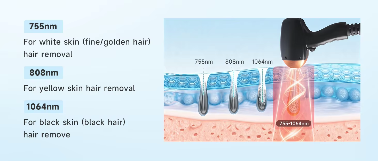 3 Wavelengths 808nm Diode Laser 755 808 1064 Diode Laser Hair Removal Machine