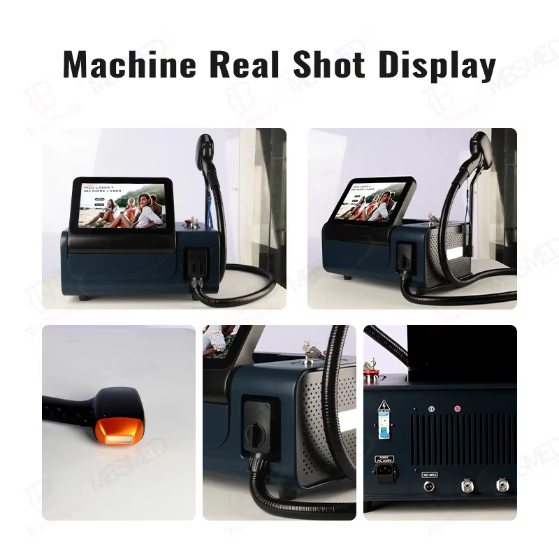 3 Wavelengths 808nm Diode Laser 755 808 1064 Diode Laser Hair Removal Machine