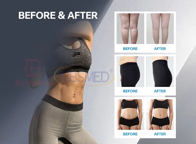 Professional EMS NEO Body Sculpt Machine 7T Electromagnetic Electronic Muscle Stimulator