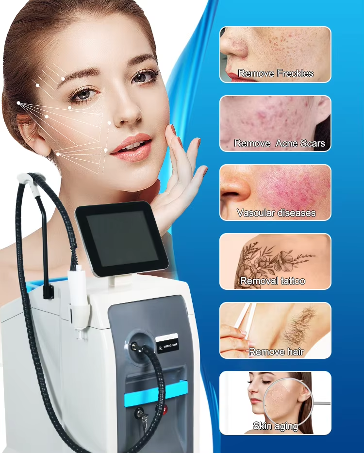755nm 1064nm Nd YAG Dual Wavelength Laser Hair Removal Tattoo Removal Machine