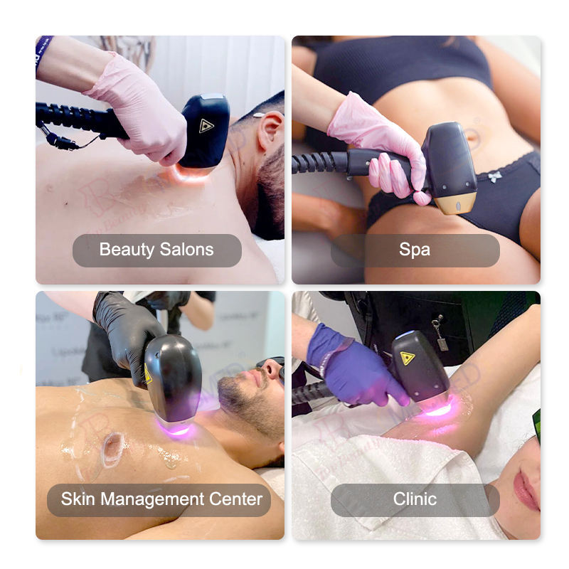 3 Wavelengths 808nm Diode Laser 755 808 1064 Diode Laser Hair Removal Machine