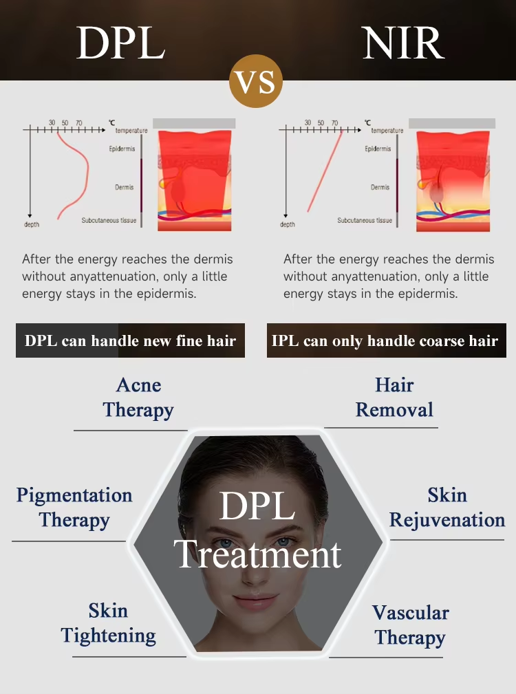 New Design DPL NIR Skin Whitening Spot Removal Skin Rejuvenation Laser Machine