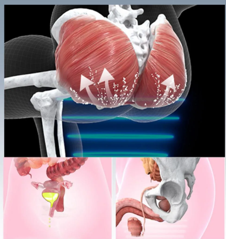 Portable Pelvic Floor Muscles Chair Cushion EMS Pelvic Floor Chair