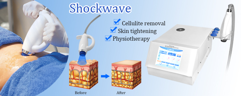 Shock Wave Device Eswt Cellulite Weight Loss Shockwave Therapy Machine