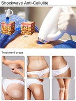Shock Wave Device Eswt Cellulite Weight Loss Shockwave Therapy Machine