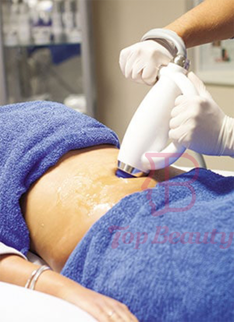 Shock Wave Device Eswt Cellulite Weight Loss Shockwave Therapy Machine