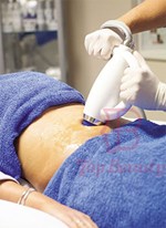 Shock Wave Device Eswt Cellulite Weight Loss Shockwave Therapy Machine